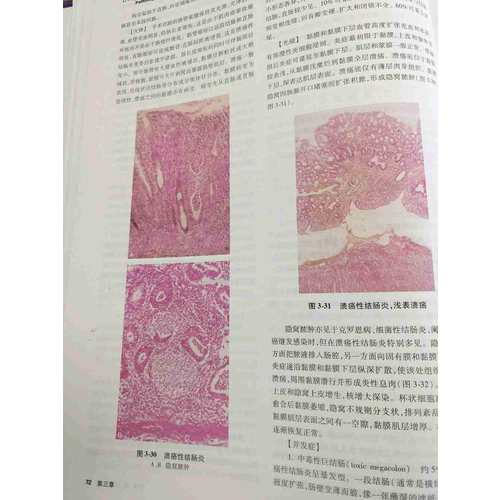 诊断病理学（第3版）