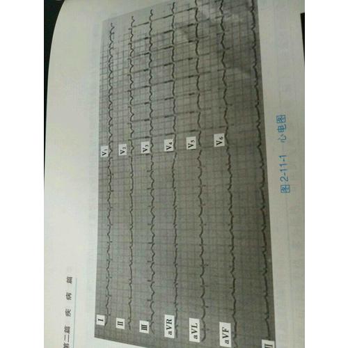 内科学(心血管内科分册）
