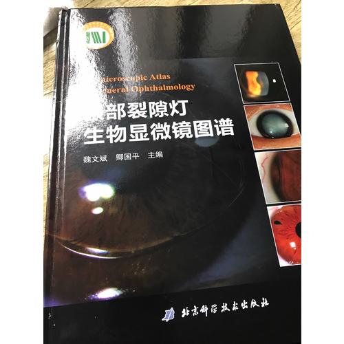 眼部裂隙灯生物显微镜图谱