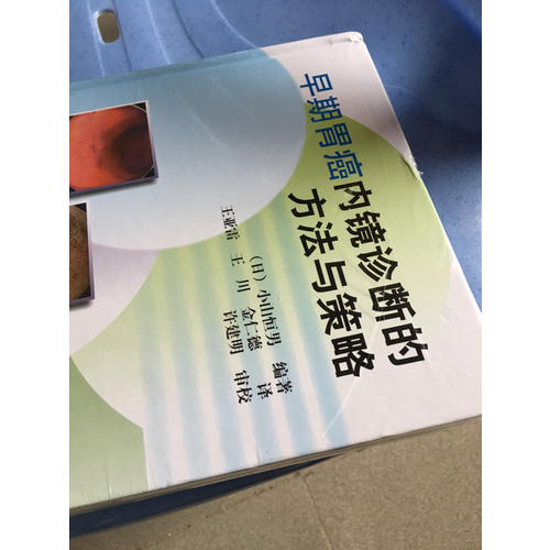 早期胃癌内镜诊断的方法与策略