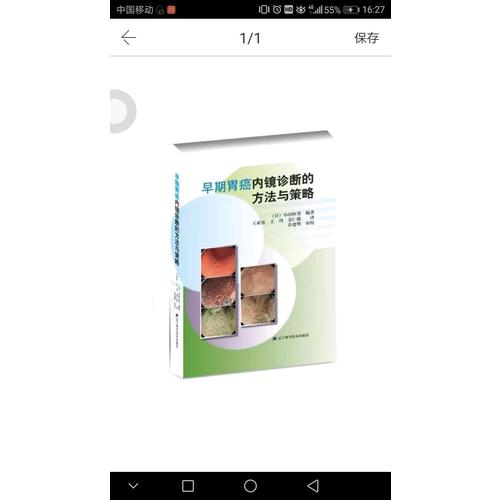 早期胃癌内镜诊断的方法与策略