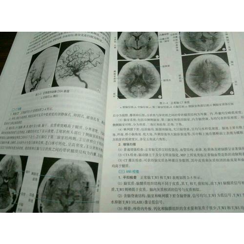 医学影像学（第七版/本科临床/十二五规划）