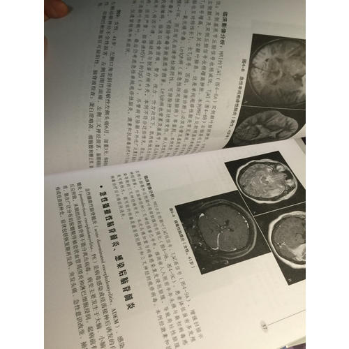 神经内科疾病影像诊断思维（第二版）