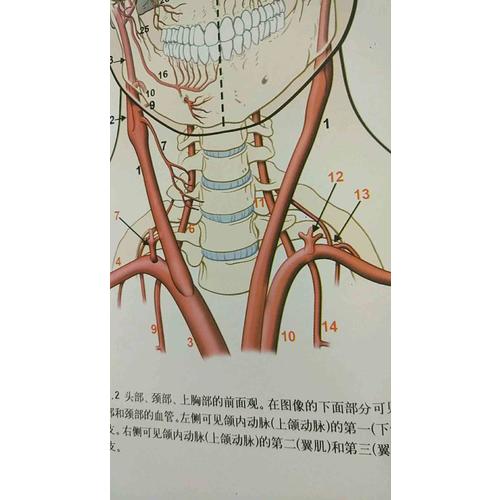 脑血管解剖及病理三维血管造影图谱