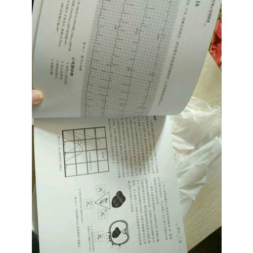 经典心电图图谱