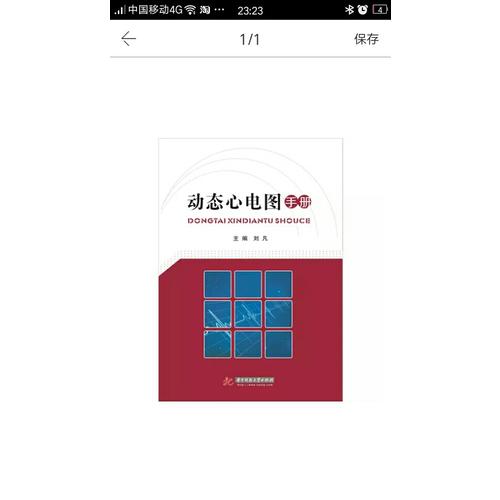动态心电图手册