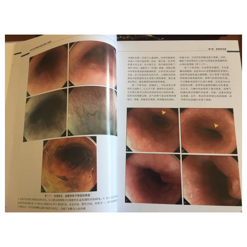 消化道早期癌内镜诊断技巧图谱（修订版）
