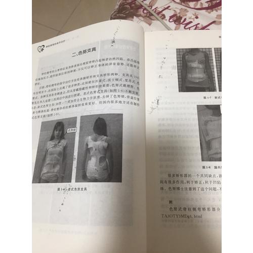 脊柱侧弯的保守治疗