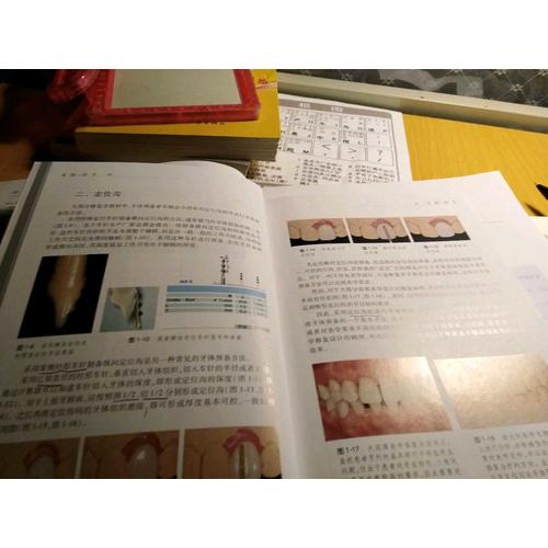 美学修复牙体预备（口腔美学修复实用教程）