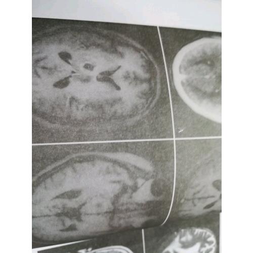 神经内科疾病影像诊断思维（第二版）