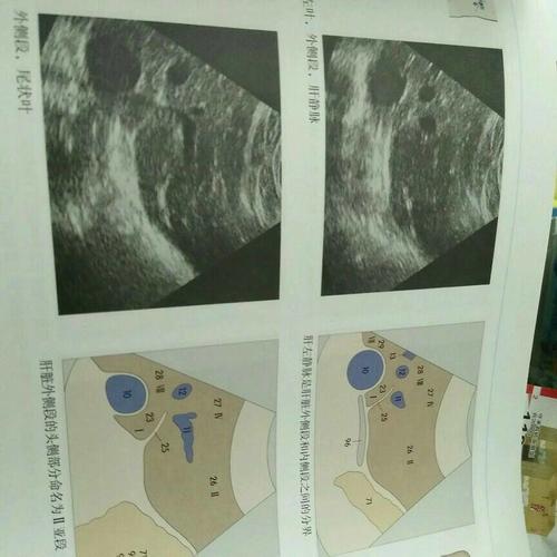 超声解剖彩色图谱（第2版）
