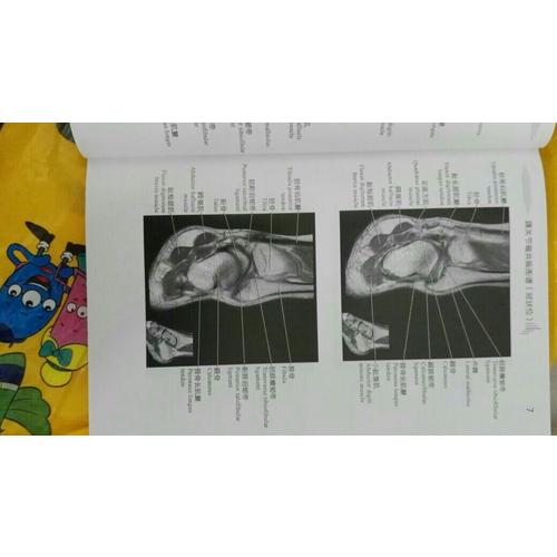 正常关节磁共振解剖图谱
