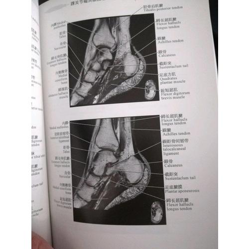 正常关节磁共振解剖图谱