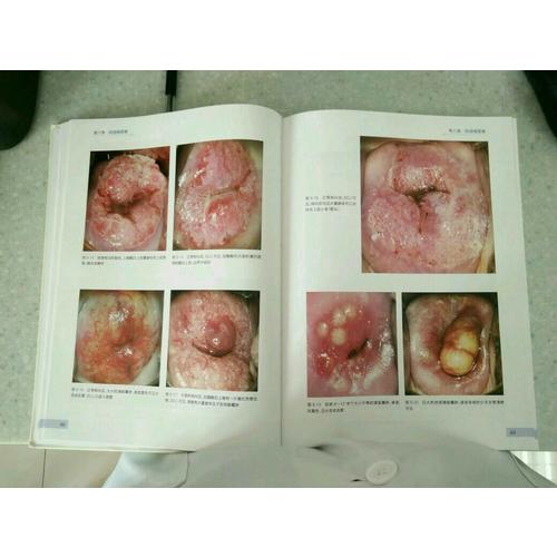 阴道镜图谱（第3版）