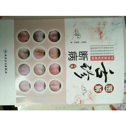 图解舌诊断病·伸伸舌头把病解