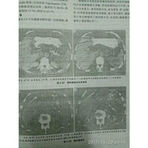 现代代谢与营养性疾病