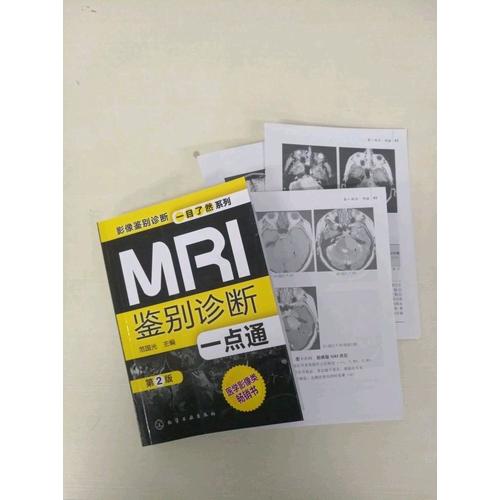 MRI鉴别诊断一点通(第二版)