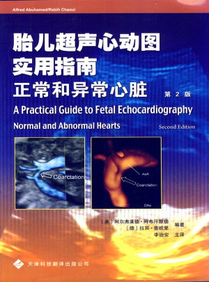 胎儿超声心动图实用指南：正常和异常心脏图书