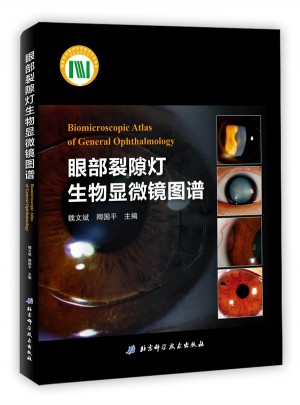 眼部裂隙灯生物显微镜图谱图书