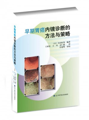 早期胃癌内镜诊断的方法与策略