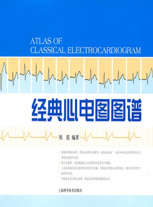 经典心电图图谱