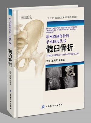 积水潭创伤骨科手术技巧：髋臼骨折