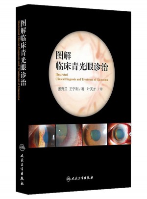 图解临床青光眼诊治