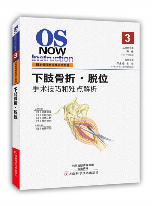 下肢骨折·脱位