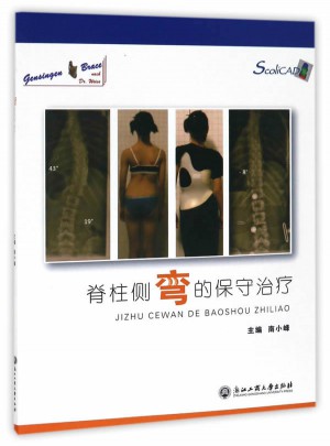 脊柱侧弯的保守治疗