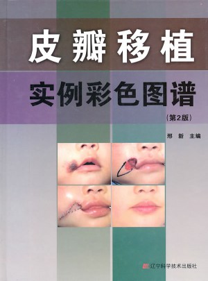皮瓣移植实例彩色图谱（第2版）图书
