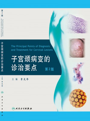 子宫颈病变的诊治要点（第2版）