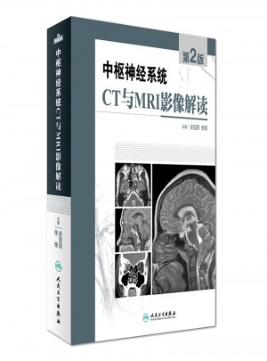 中枢神经系统CT和MRI影像解读（第2版）图书