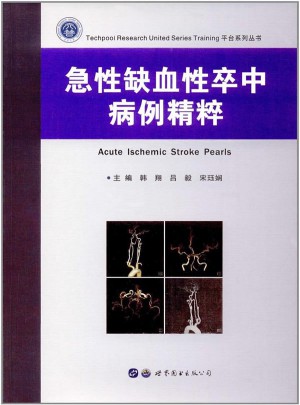 急性缺血性卒中病例精粹