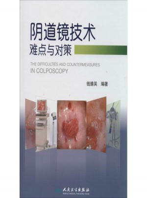 阴道镜技术难点与对策