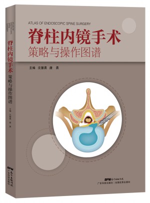 脊柱内镜手术策略与操作图谱