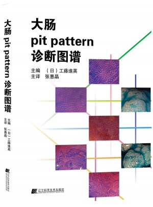 大肠pit pattern诊断图谱图书