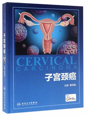 子宫颈癌(配增值)