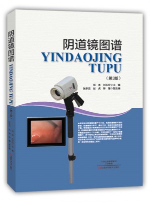 阴道镜图谱（第三版）