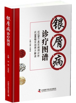 银屑病诊疗图谱