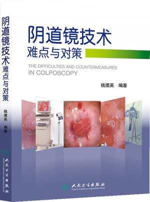 阴道镜技术难点与对策